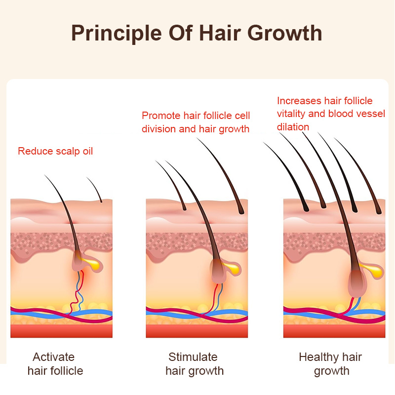 660nm red laser hair growth cap